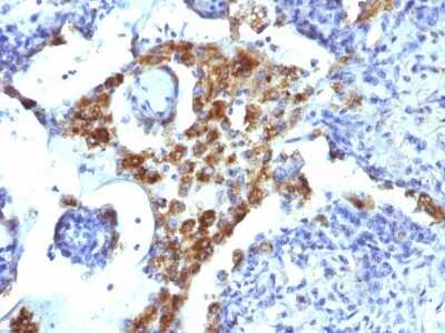 Immunohistochemistry-Paraffin: Napsin A Antibody (NAPSA/1239) [NBP2-45245]