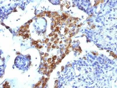 Immunohistochemistry-Paraffin: Napsin A Antibody (NAPSA/1239) - BSA Free [NBP2-54384]