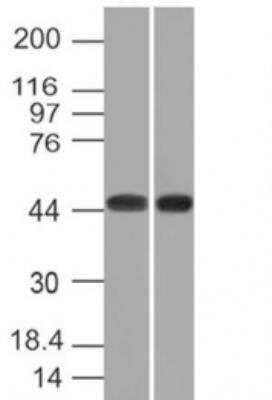 Western Blot: Napsin A Antibody (NAPSA/1239) [NBP2-45245]