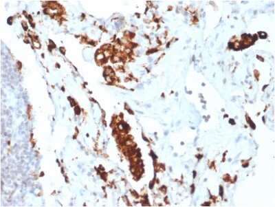 Immunohistochemistry-Paraffin: Napsin A Antibody (NAPSA/1865R) - Azide and BSA Free [NBP3-08379]