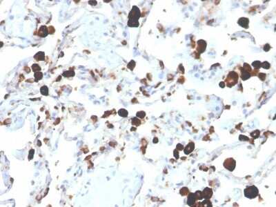 Immunohistochemistry-Paraffin: Napsin A Antibody (NAPSA/3305) - Azide and BSA Free [NBP3-08375]