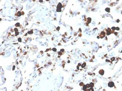 Immunohistochemistry-Paraffin: Napsin A Antibody (NAPSA/3305) [NBP3-07866]