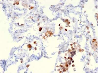 Immunohistochemistry-Paraffin: Napsin A Antibody (NAPSA/3306) [NBP3-07867]