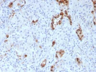 Immunohistochemistry-Paraffin: Napsin A Antibody (NAPSA/3307) [NBP3-07868]