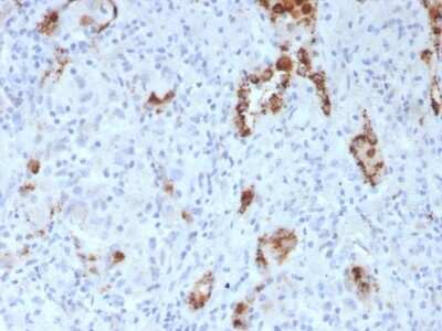 Immunohistochemistry-Paraffin: Napsin A Antibody (NAPSA/3307) - Azide and BSA Free [NBP3-08377]