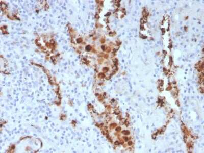 Immunohistochemistry-Paraffin: Napsin A Antibody (NAPSA/3307) - Azide and BSA Free [NBP3-08377]