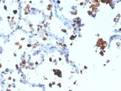 Immunohistochemistry-Paraffin: Napsin A Antibody (NAPSA/3308) - Azide and BSA Free [NBP3-08368]