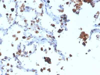 Immunohistochemistry-Paraffin: Napsin A Antibody (NAPSA/3308) [NBP3-07862]