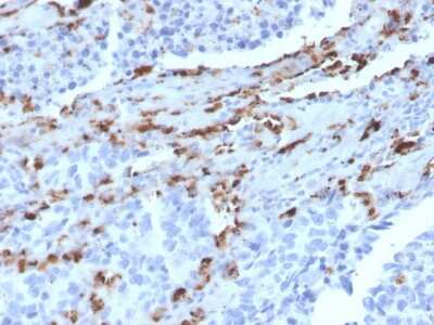 Immunohistochemistry-Paraffin: Napsin A Antibody (NAPSA/3309) [NBP3-07863]