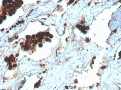 Immunohistochemistry-Paraffin: Napsin A Antibody (NAPSA/4400R) [NBP3-07869]