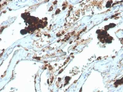 Immunohistochemistry-Paraffin: Napsin A Antibody (NAPSA/4400R) [NBP3-07869]