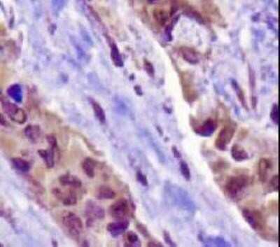 Immunohistochemistry: Napsin A Antibody (TMU-Ad02) - Azide and BSA Free [NBP2-80866]