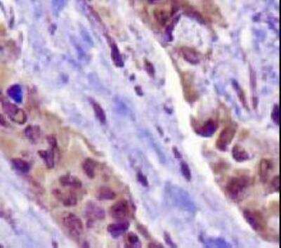 Immunohistochemistry-Paraffin: Napsin A Antibody (TMU-Ad02) [NB110-68133]