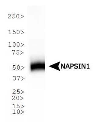 Western Blot: Napsin A Antibody (TMU-Ad02) [NB110-68133]