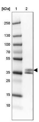 Western Blot: Napsin A Antibody [NBP2-33499]