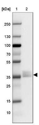 Western Blot: Napsin A Antibody [NBP2-34212]