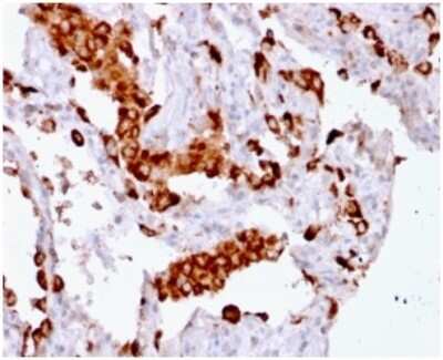 Immunohistochemistry-Paraffin: Napsin A Antibody (rNAPSA/1239) - Azide and BSA Free [NBP3-08374]