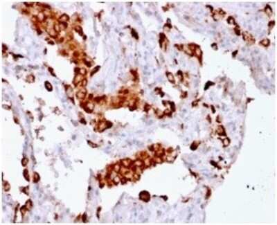 Immunohistochemistry-Paraffin: Napsin A Antibody (rNAPSA/1239) [NBP3-07865]