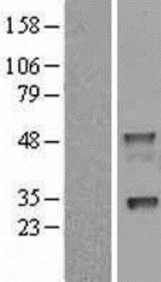 Western Blot: Napsin A Overexpression Lysate [NBL1-13479]