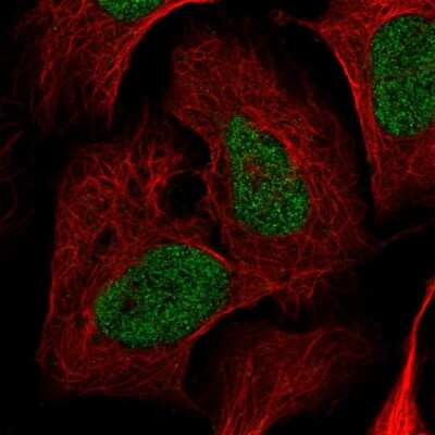 Immunocytochemistry/ Immunofluorescence: Nardilysin Antibody [NBP2-58484]