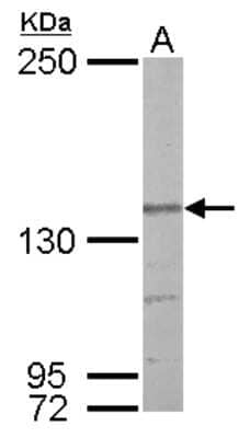 Western Blot: Nardilysin Antibody [NBP2-19472]