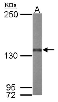 Western Blot: Nardilysin Antibody [NBP2-19473]