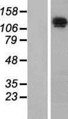 Western Blot: Nardilysin Overexpression Lysate [NBP2-10834]