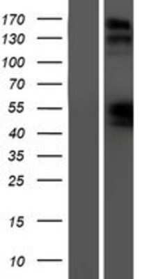 Western Blot: NPRB/NPR2 Overexpression Lysate [NBP2-10563]