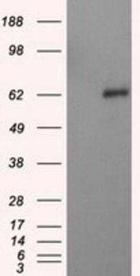 Western Blot: Natriuretic Peptide Receptor C Antibody (OTI4C3) [NBP2-02401]