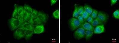 Immunocytochemistry/ Immunofluorescence: Natriuretic Peptide Receptor C Antibody [NBP1-31365]