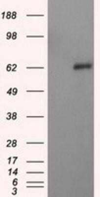 Western Blot: Natriuretic Peptide Receptor C Antibody (OTI4C3)Azide and BSA Free [NBP2-72881]