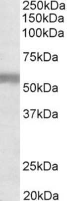 Western Blot: Natriuretic Peptide Receptor C Antibody [NBP1-97777]