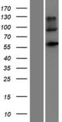 Western Blot: Natriuretic Peptide Receptor C Overexpression Lysate [NBL1-13755]