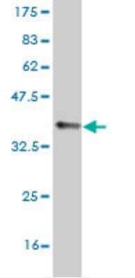 Western Blot: Nav1.6 Antibody (4G7) [H00006334-M04]