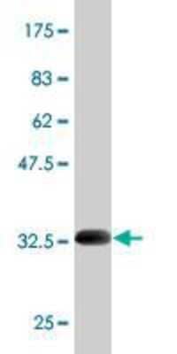 Western Blot: Nav1.7 Antibody (5A11) [H00006335-M01]