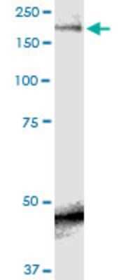 Western Blot: Nav1.7 Antibody (5A11) [H00006335-M01]