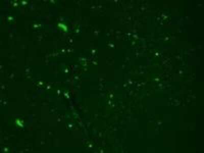 Immunocytochemistry/ Immunofluorescence: Nav1.7 Antibody (N68/6) [NBP2-12904]