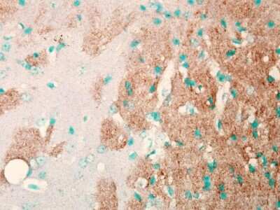 Immunohistochemistry: Nav1.7 Antibody (N68/6) [NBP2-12904]