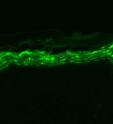 Immunohistochemistry: Nav1.7 Antibody (N68/6) [NBP2-12904]