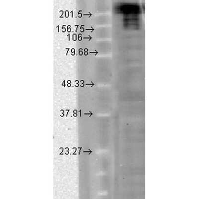 Western Blot: Nav1.7 Antibody (N68/6) [NBP2-12904]