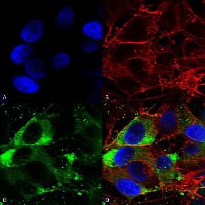 Immunocytochemistry/ Immunofluorescence: Nav1.8 Antibody (S134) [NBP1-47615]
