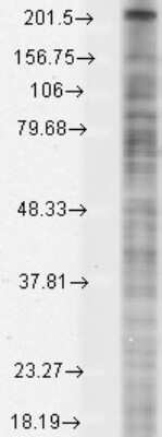 Western Blot: Nav1.8 Antibody (S134) [NBP1-47615]