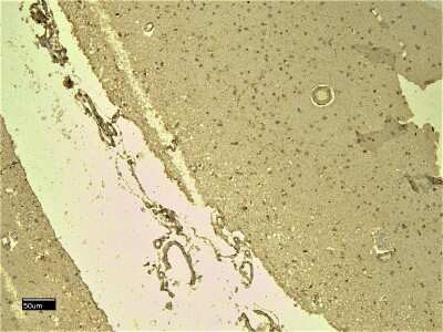 Immunohistochemistry-Paraffin: Nav1.5 Antibody [NB600-804]