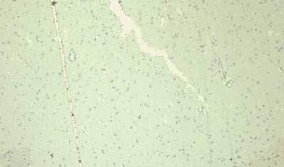 Immunohistochemistry-Paraffin: Nav1.5 Antibody [NB600-804]