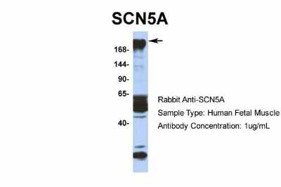 Western Blot: Nav1.5 Antibody [NBP2-86725]