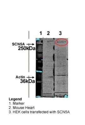 Western Blot: Nav1.5 Antibody [NBP2-86726]