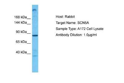 Western Blot: Nav1.5 Antibody [NBP2-86727]