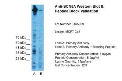 Western Blot: Nav1.5 Antibody [NBP2-86727]