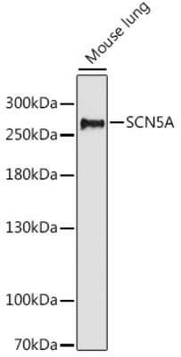 Western Blot: Nav1.5 AntibodyAzide and BSA Free [NBP2-94760]