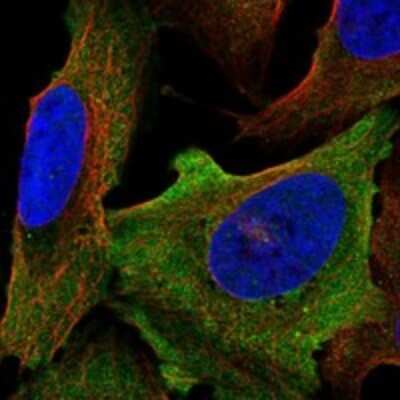 Immunocytochemistry/ Immunofluorescence: Nav1.6 Antibody [NBP3-17279]